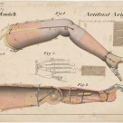 Patent drawing of Artificial Arm by John Condell, 1865.